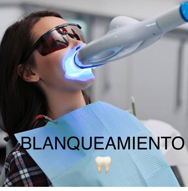Servicio de endodoncia